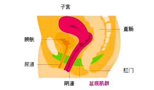 盆底肌松弛漏尿如何治疗？